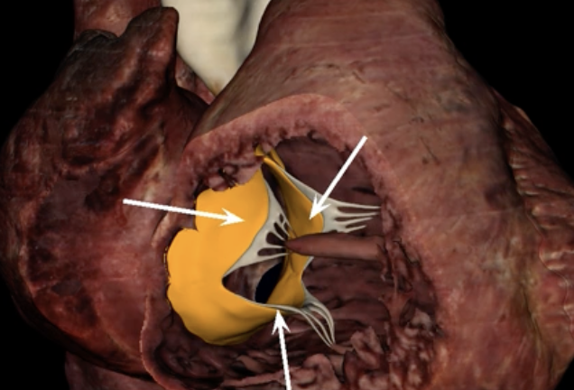 <p>What are the arrows pointing to?</p>