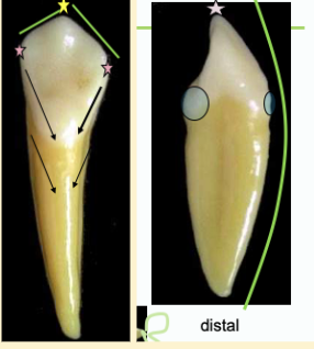 <p><mark data-color="#ffc1ec" style="background-color: #ffc1ec; color: inherit">mandibular canines #22 and #27; depression</mark></p>