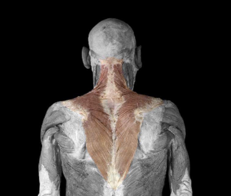 <p>What muscle is this?</p>