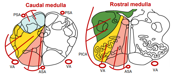 <p>Main arterial output to the posterior circulatory system. Damage could be life threatening</p><p></p>