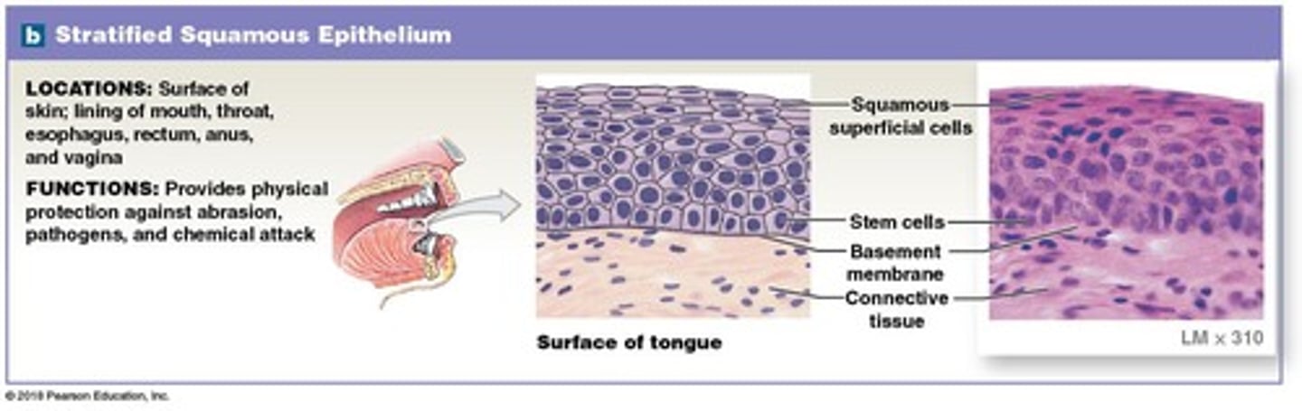 <p>In areas that require protection against mechanical stresses.</p>