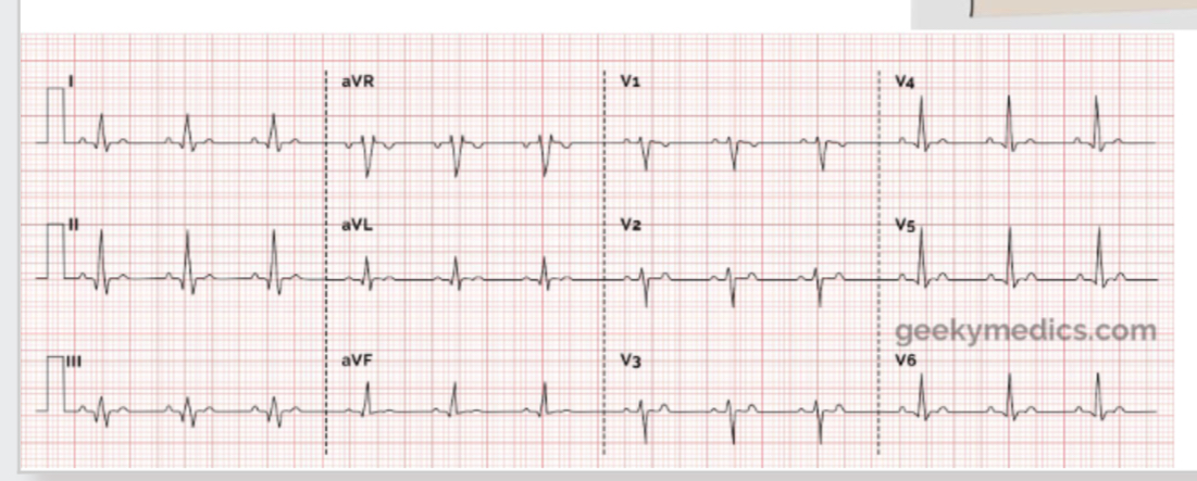 <p>How do we measure movement of electrical current in heart?</p>