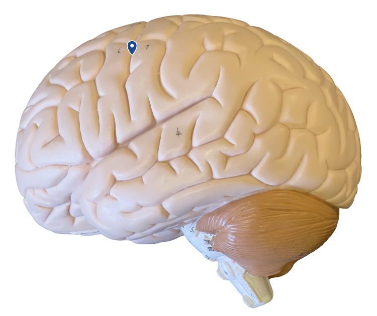 <p>What sulcus is the arrow pointing to?</p>