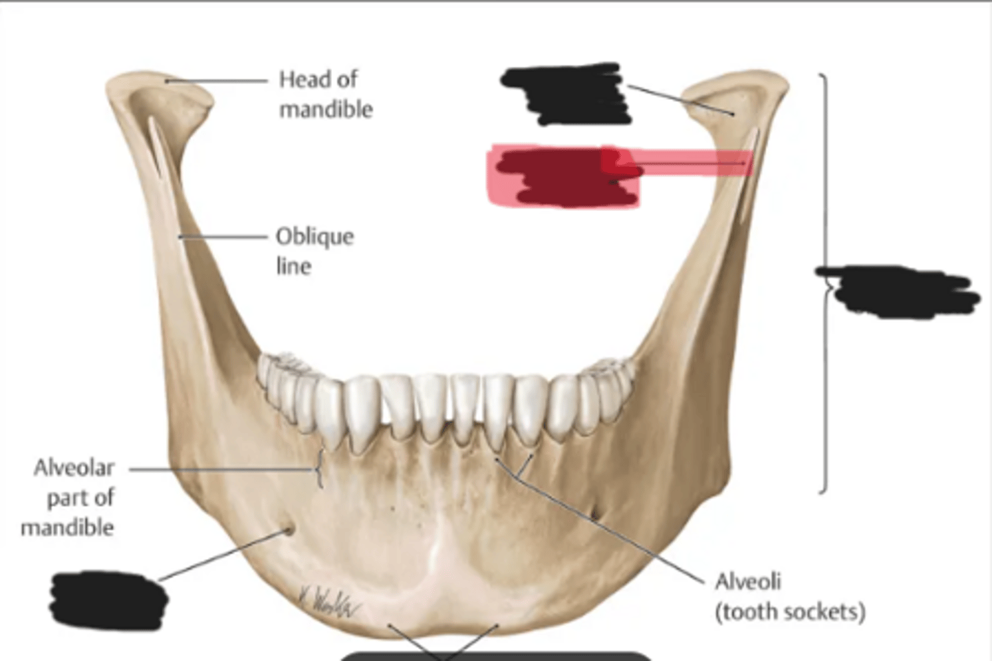 <p>Coronoid process of the mandible</p>