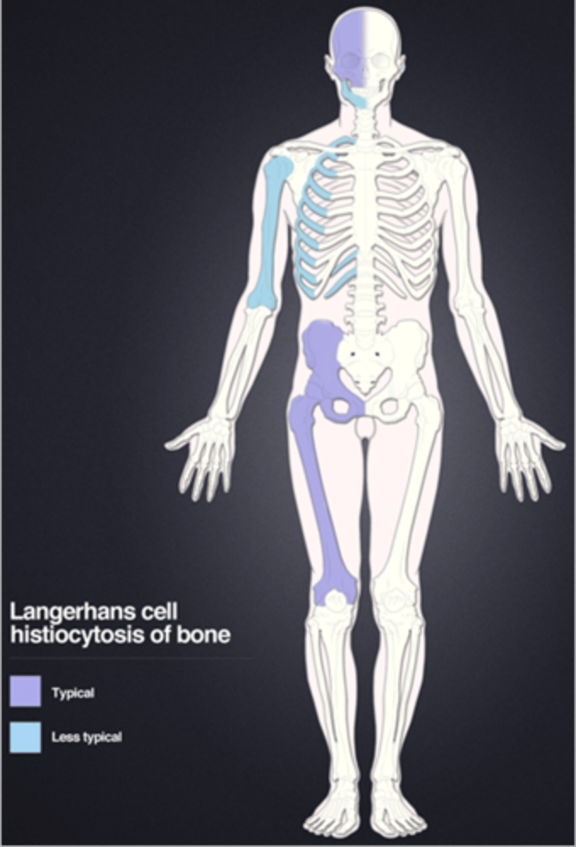 <p>Eosinophilic granuloma is a type of _____</p>