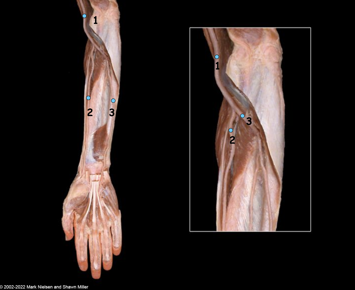 <p>What is number 1?</p>