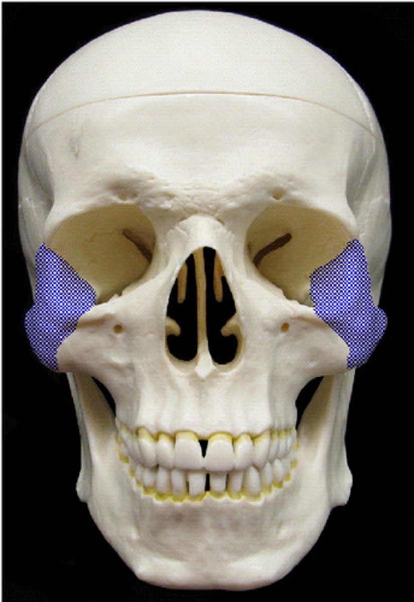 <p>Cheekbones, inferolateral margins of orbits</p>