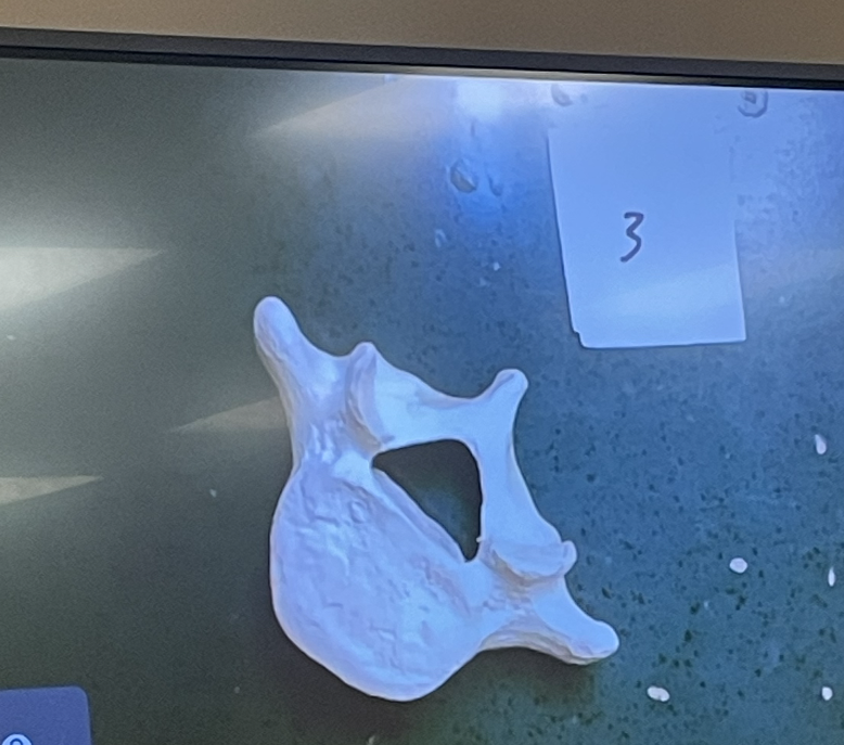 anatomy vertebral column and ribs practical Flashcards Knowt