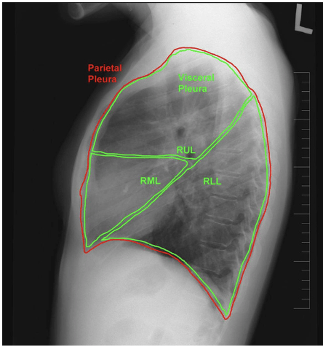 <p>refer to picture</p>