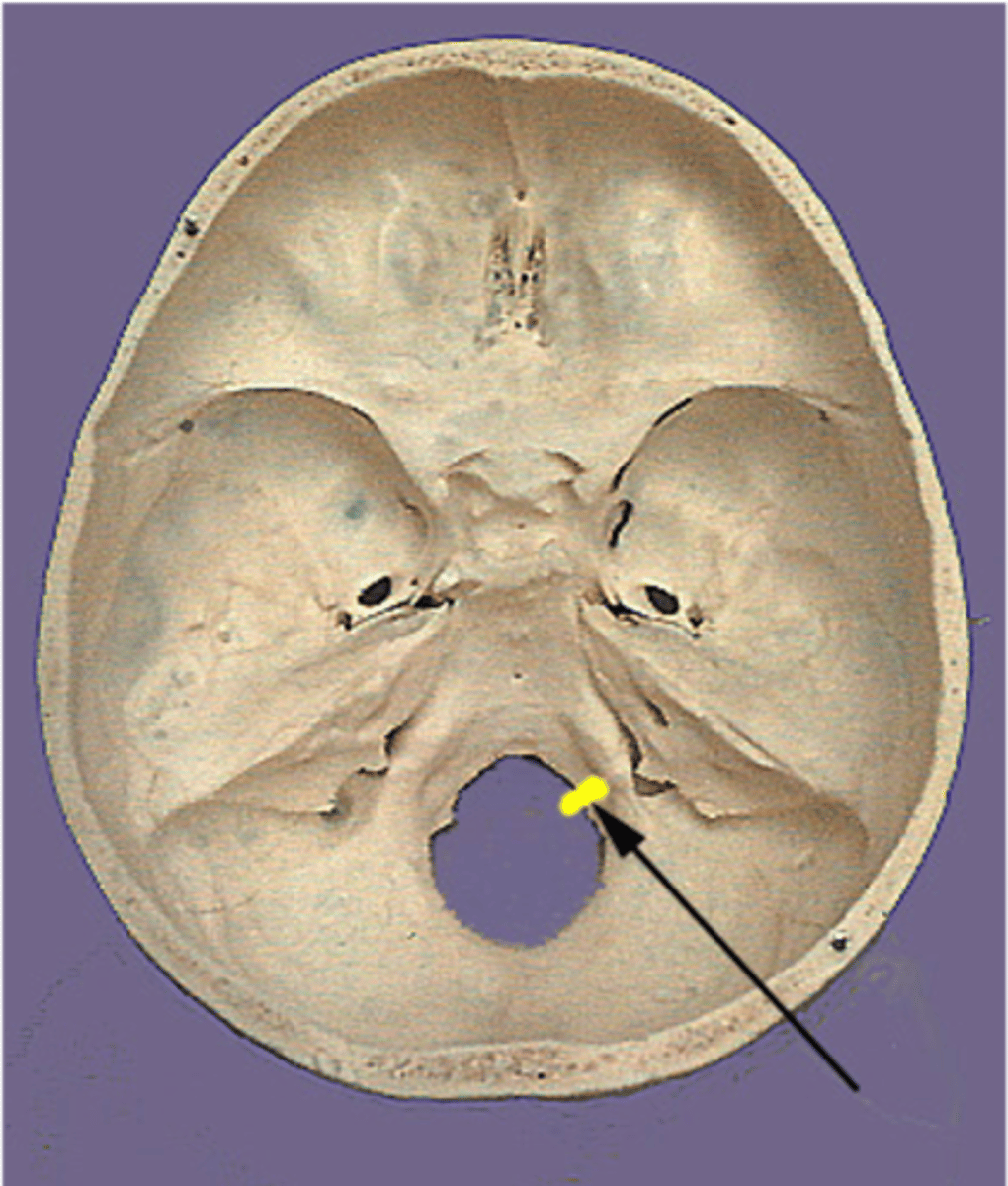 <p>Hypoglossal canal</p>