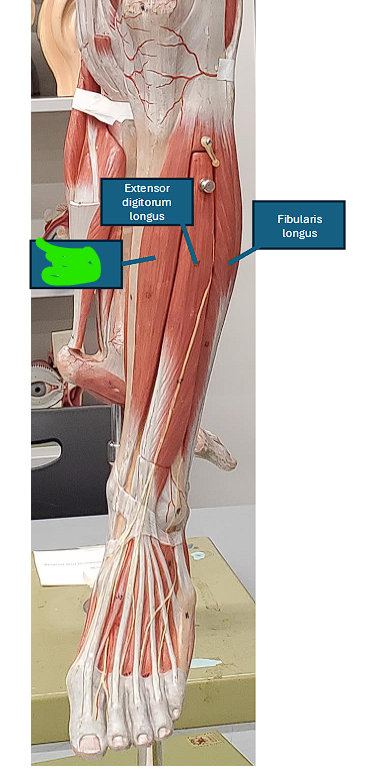 <ul><li><p><strong>Dorsiflexes</strong> and<u> inverts</u> the foot </p></li></ul><p></p>