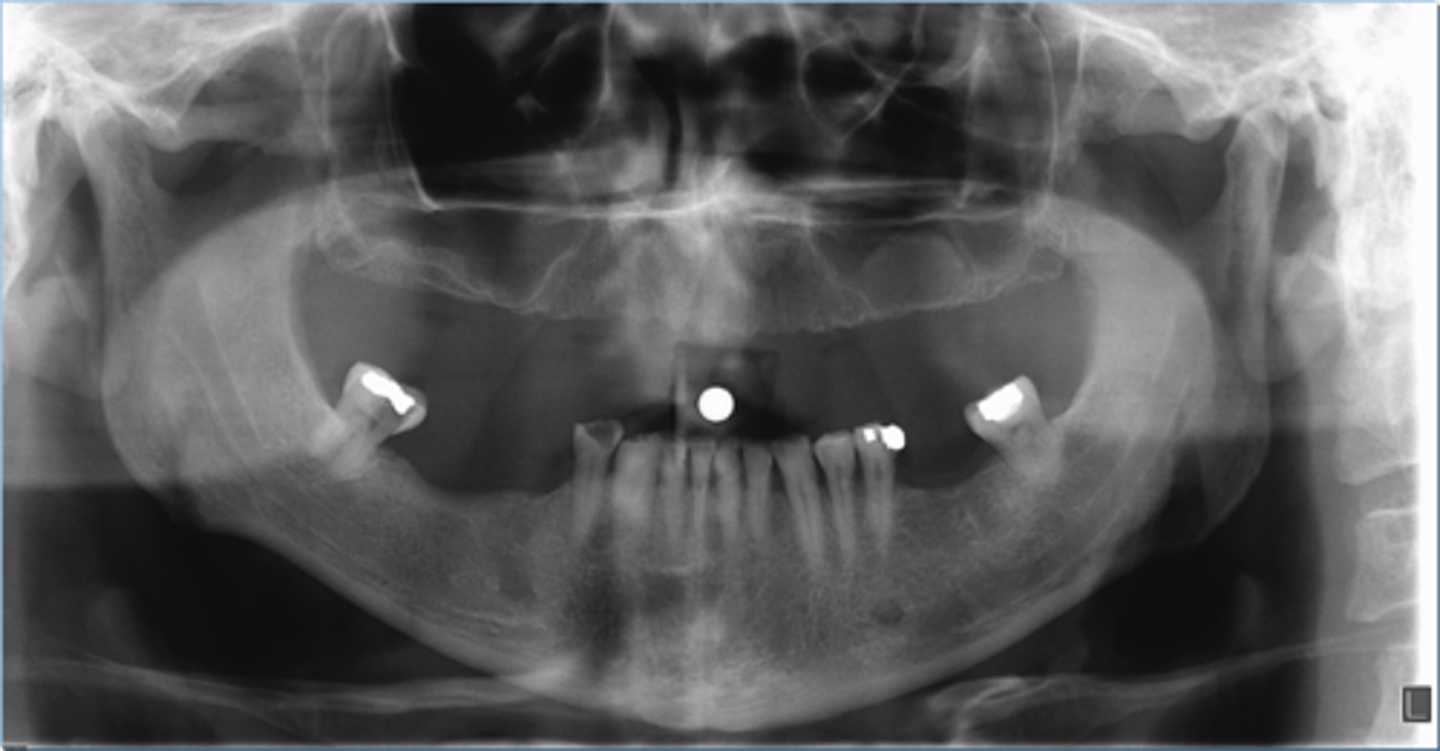 <p>ID the cyst:</p>