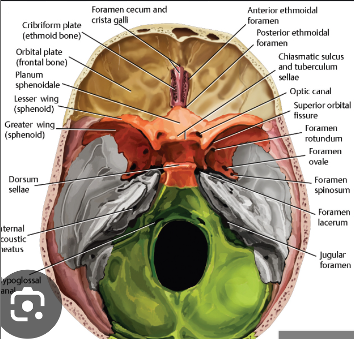 <p>Posterior ethmoid foramen</p>