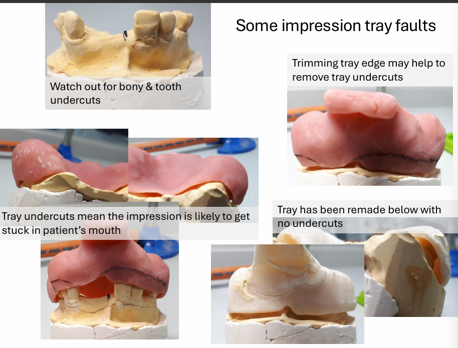<ul><li><p>this undercut will be transferred onto the special tray</p></li><li><p>tray undercuts mean the impression is likely to get stuck in the patient’s mouth</p></li><li><p>trimming tray edge may help to remove tray undercuts</p></li></ul><p></p>