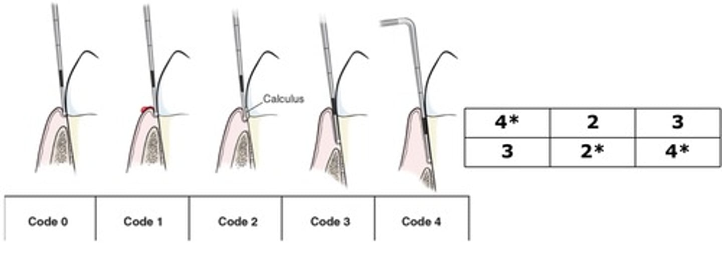 <p>-each tooth is probed using a special color-coded probe with a ball tip that helps detect calculus</p><p>-each sextant receives a code based on the deepest probing depth found in that sextant</p><p>-if a Code 4 is found, probing of that sextant can stop.</p><p>-the highest code recorded in all sextants is used to determine the patient's assessment and treatment planning needs.</p>
