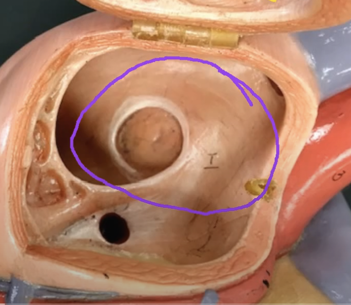 <p>What does this purple circle represent.. </p>