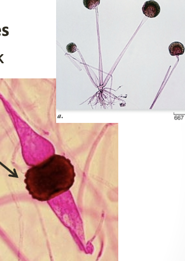 <p>Phylum Zygomycota</p>