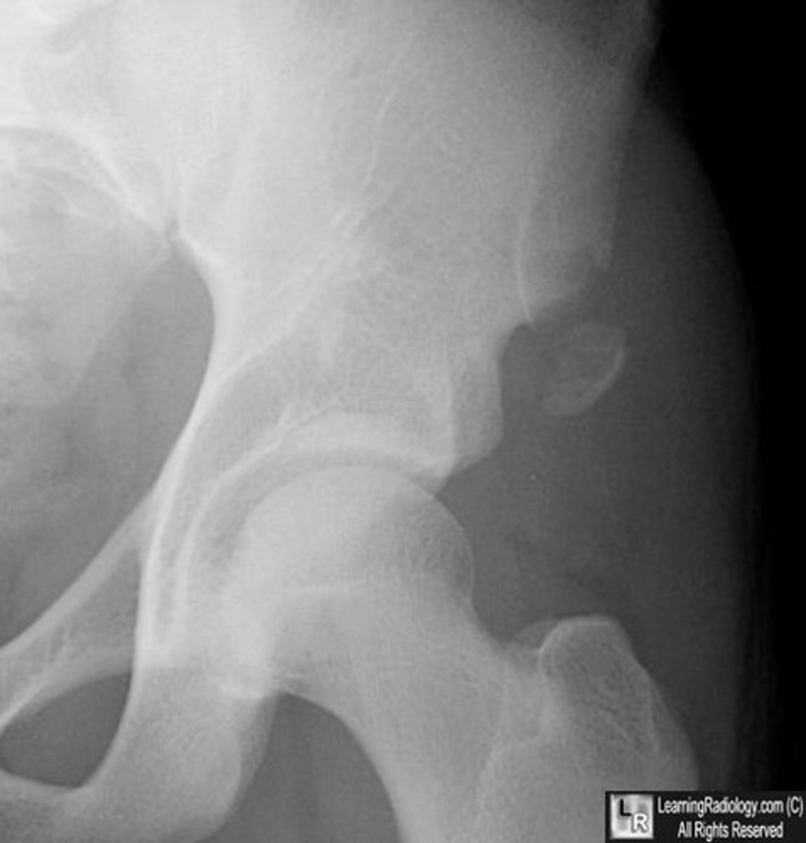 <p>What pathology is this?</p>