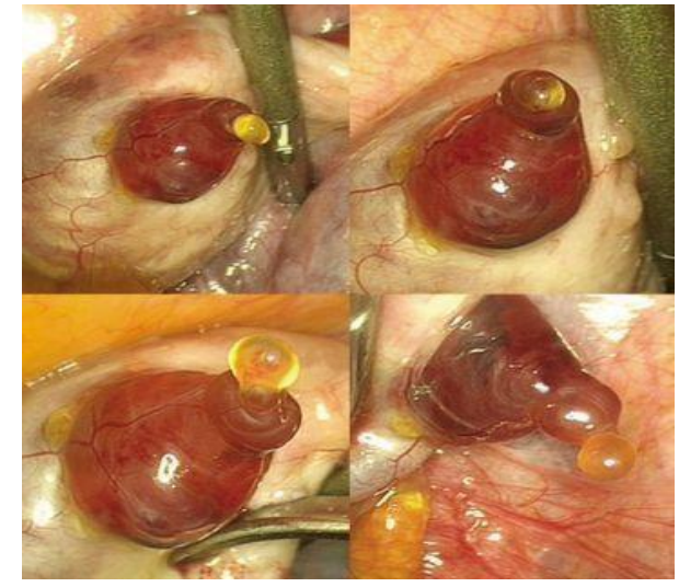 <p>Ovulation Diagram</p>