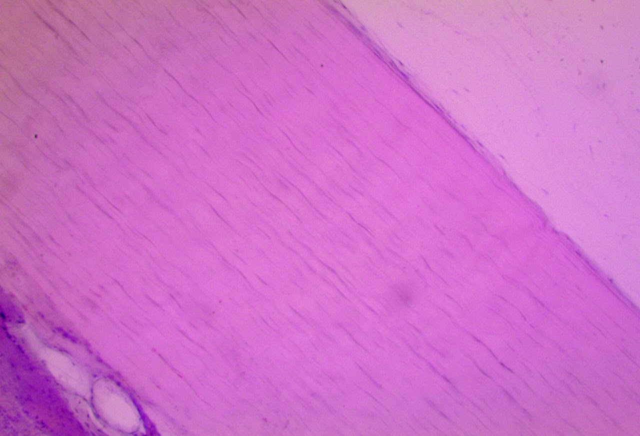 <p><span>Found in tendons &amp; ligaments</span></p>