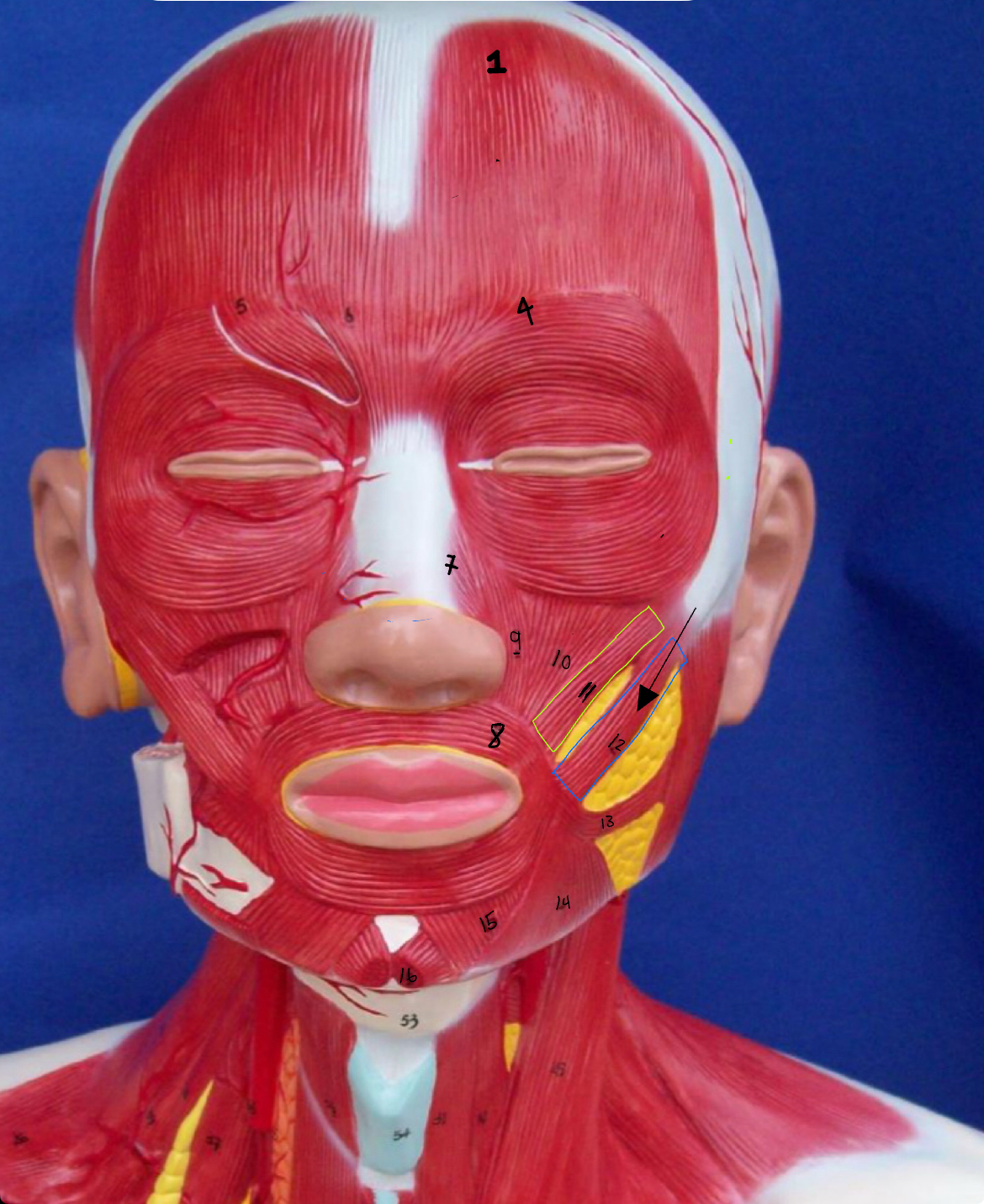 <p>what type of muscle is this (altay)</p>