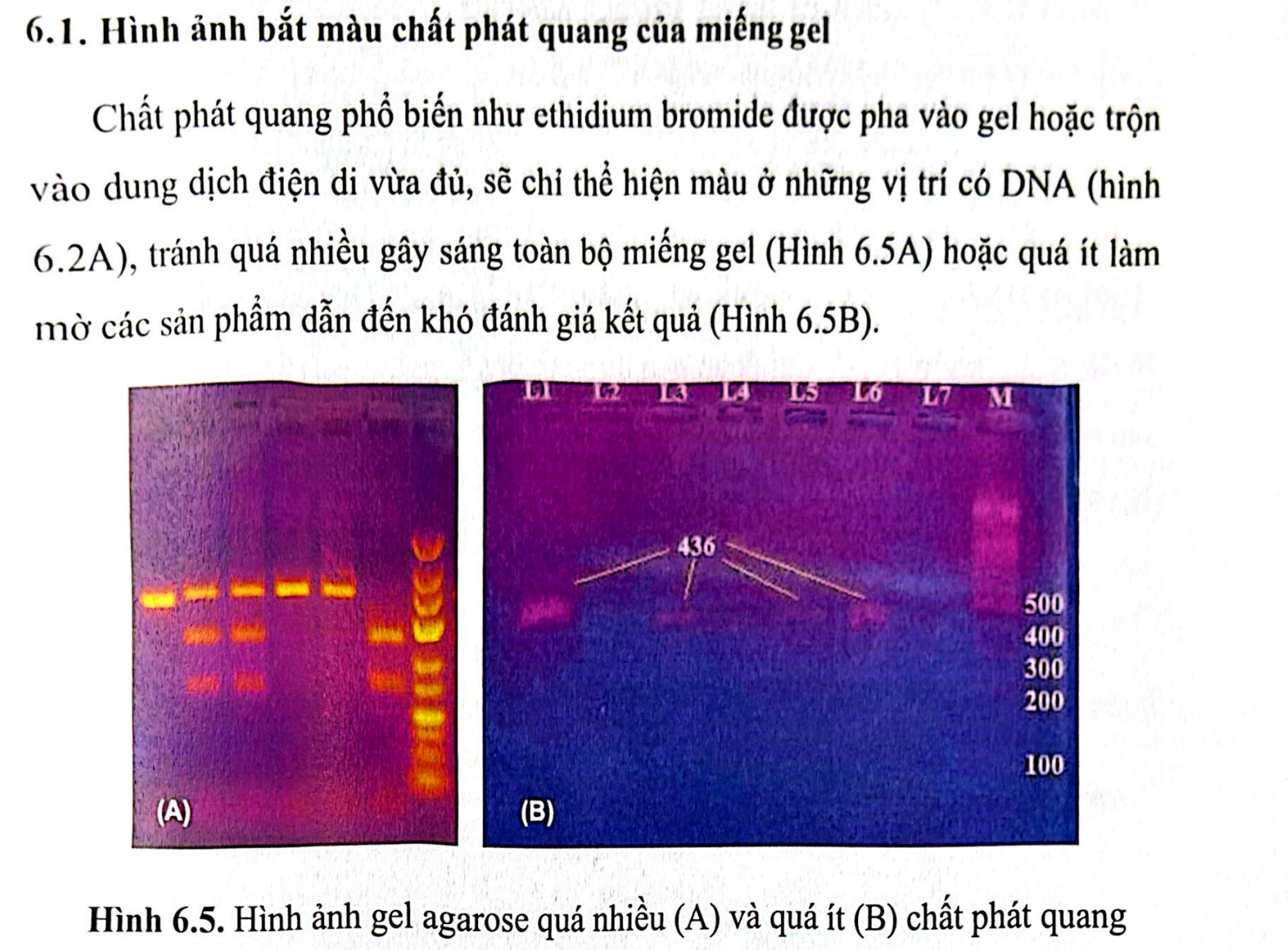 <p><span style="color: blue;">C. Gel agarose có quá nhiều EtBr</span></p><ul data-type="taskList"><li data-checked="true" data-type="taskItem"><label><input type="checkbox" checked="checked"><span></span></label><div><p><strong>EtBr</strong>: chất phát quang màu cam</p></div></li></ul><p></p>