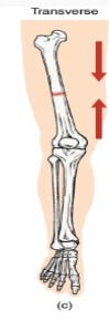 <p>Occurs straight across the long axis of the bone </p>