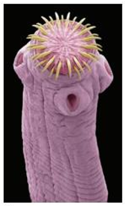 <p>the head of a tapeworm either in the larva or adult stage from which the proglottids are produced by budding</p>