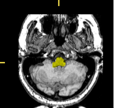 <p>What part of the brain is highlighted?</p>