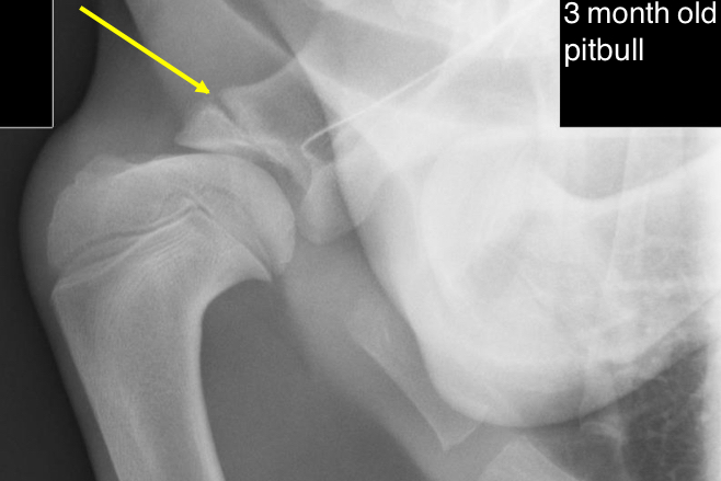 <ul><li><p>supraglenoid</p></li></ul>