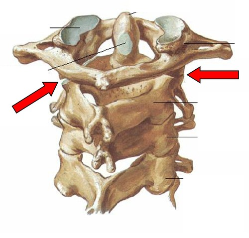 <p>articulation between Atlas C1 &amp; Axis C2</p><ul><li><p>allows us to move our heads from side to side </p></li></ul><ul><li><p>diarthrotic</p></li><li><p>synovial</p></li><li><p>pivot</p></li></ul><p></p>