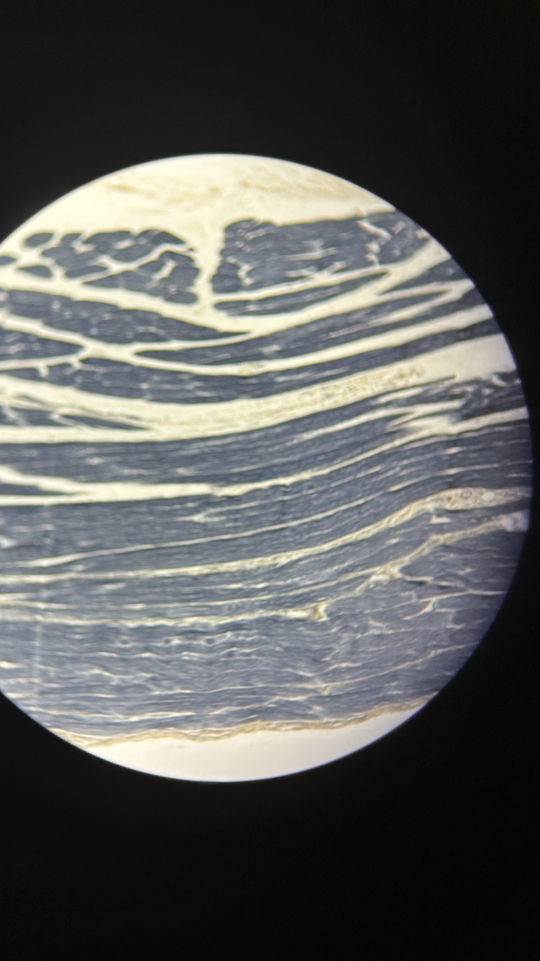 <p>What is the magnification level of the Skeletal Muscle?</p>