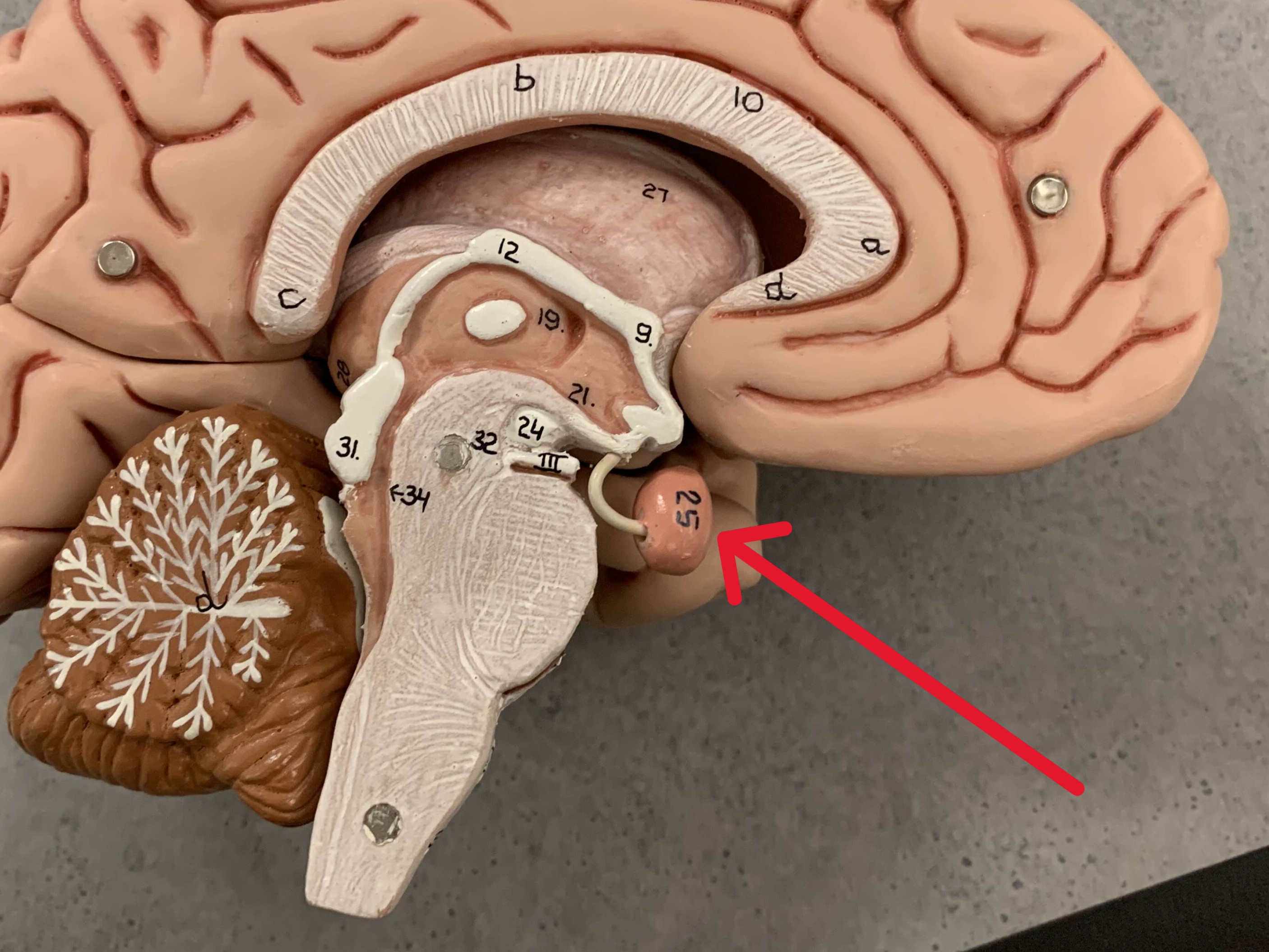 <p>Which part of the brain is:</p><ul><li><p>Small bean-shaped</p></li><li><p>Inferior to hypothalamus</p></li><li><p>Connected by infundibulum</p></li></ul><p></p>