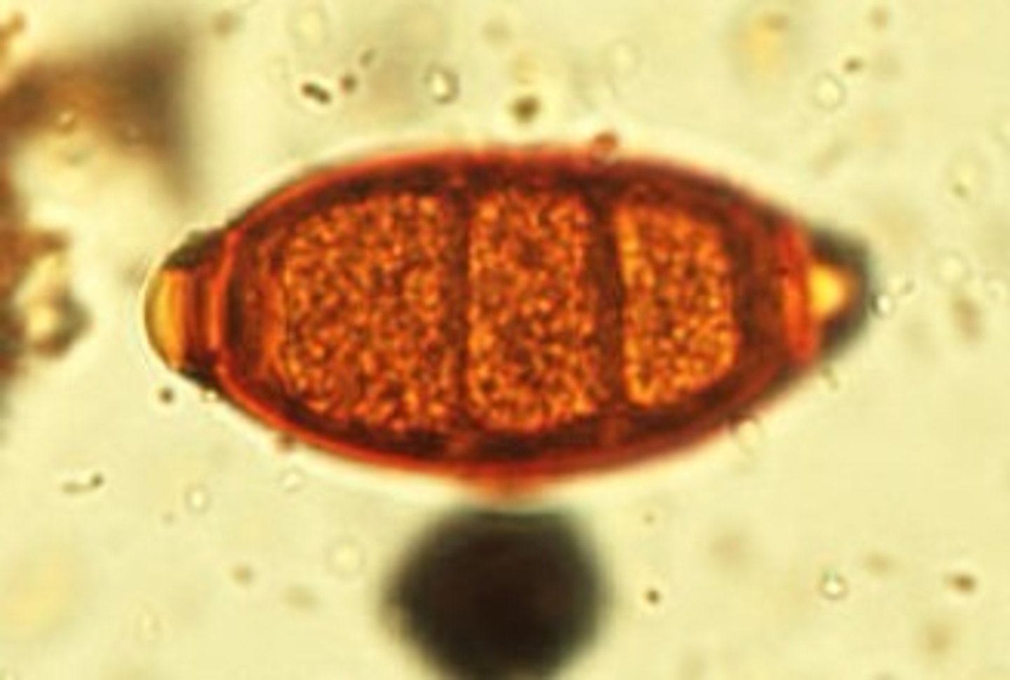 <p>Identify the parasite</p>