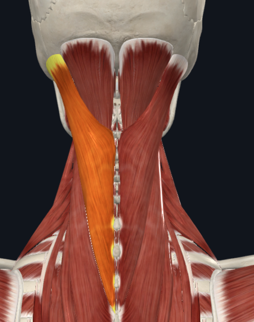<p>What muscle is this</p>