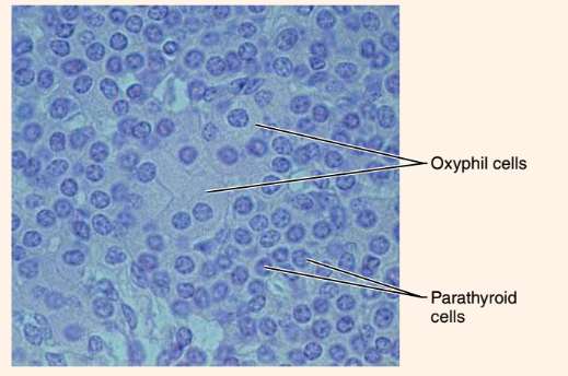 <p>What endocrine organ or gland is this?</p>