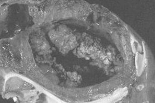 <p><span>Bacterial Endocarditis in horses</span></p>