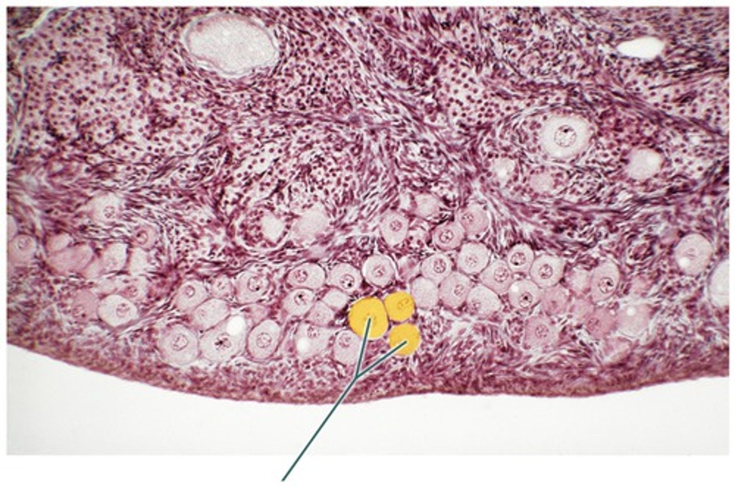 <p>most immature, made of single layer squamous cells surrounding oocyte</p>