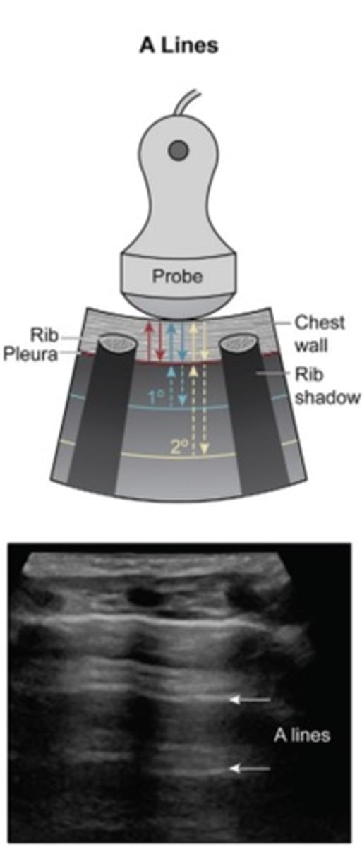 <p>Horizontal</p><p>Seen in normal lung</p>