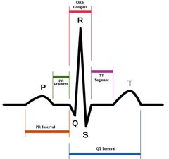 -P wave=atrial depolarization/contraction
-QRS wave=ventricular depolarization/contraction (atrial repolarization)
-T wave=ventricular repolarization/relaxation
-U wave=not visible but represents repolarization of bundle of His and Purknje fibers