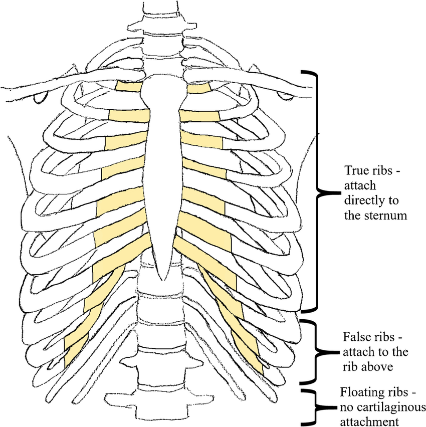 <p><span><span>true- cartilage directly to the sternum (pairs 1-7)</span></span><br><span><span>flase- cartilage looping up to rib above (pairs 8-10)</span></span><br><span><span>floating- no cartilage + at back (pairs 11 + 12)</span></span></p>