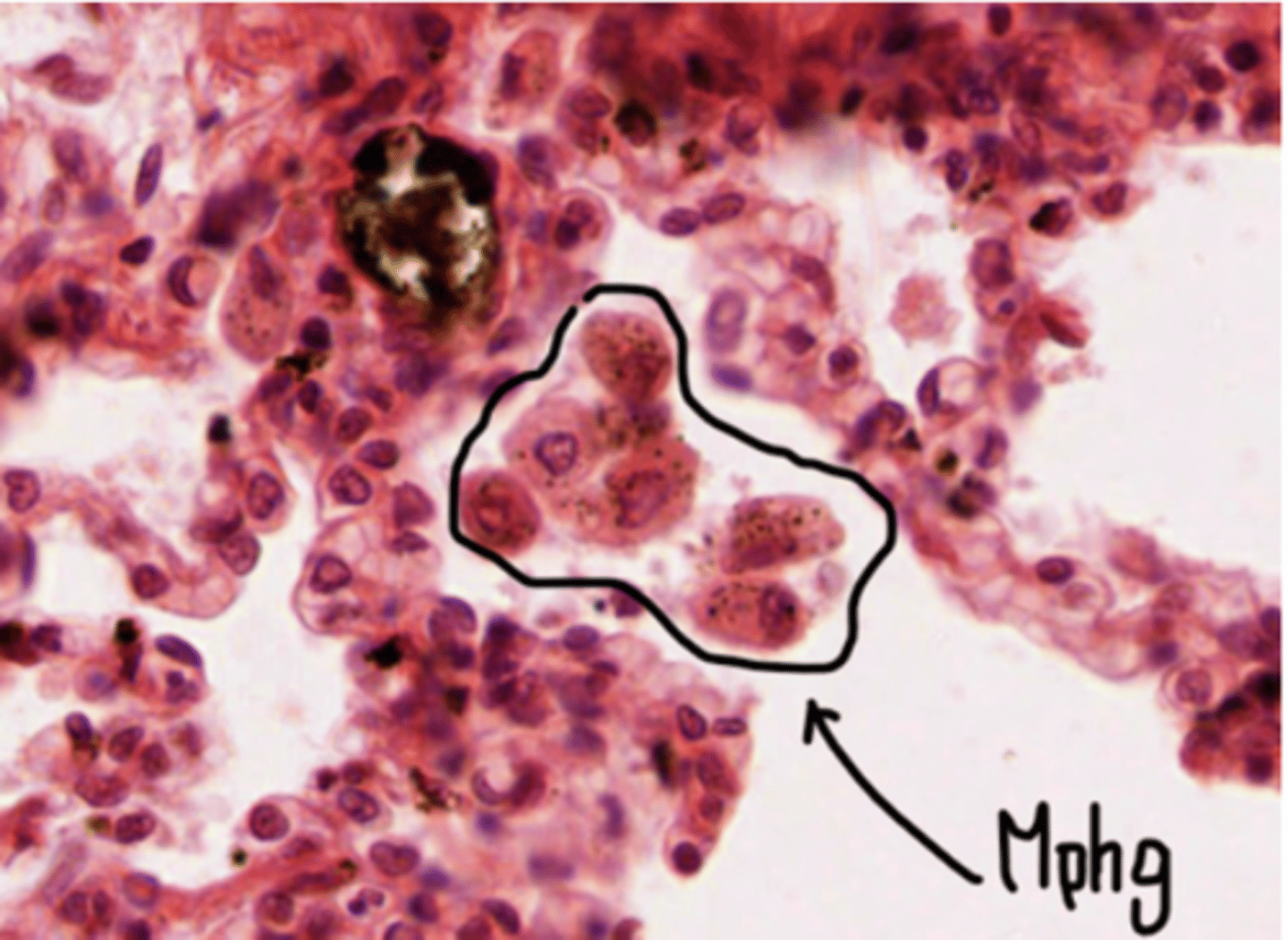 <p>carry out phagocytosis</p>