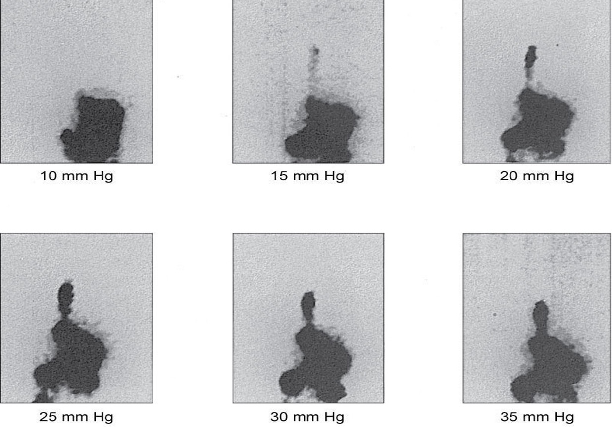 <p>is this a pedi or adult?</p>