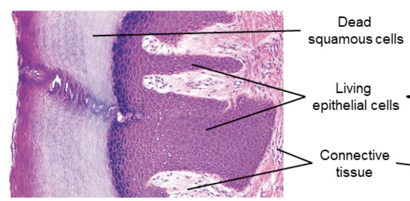 <p>ex: mammalian skin, where the top layer of skin is dead</p>