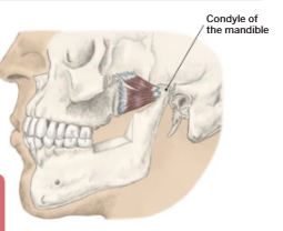 <p>Lateral pterygoid</p>