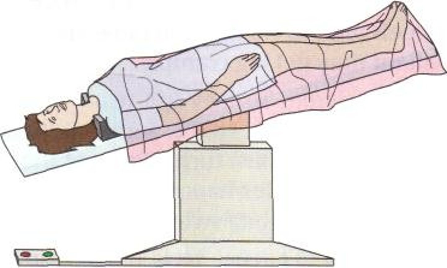<p>Lying on back with bed tilted so that the head is lower than the feet<br><br>Used during insertion/removal of peripheral or jugular PICC lines</p>
