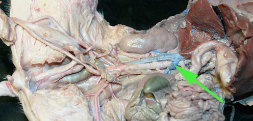 <p><span>The vein marked by the green arrow is a  </span><strong>renal vein</strong></p>