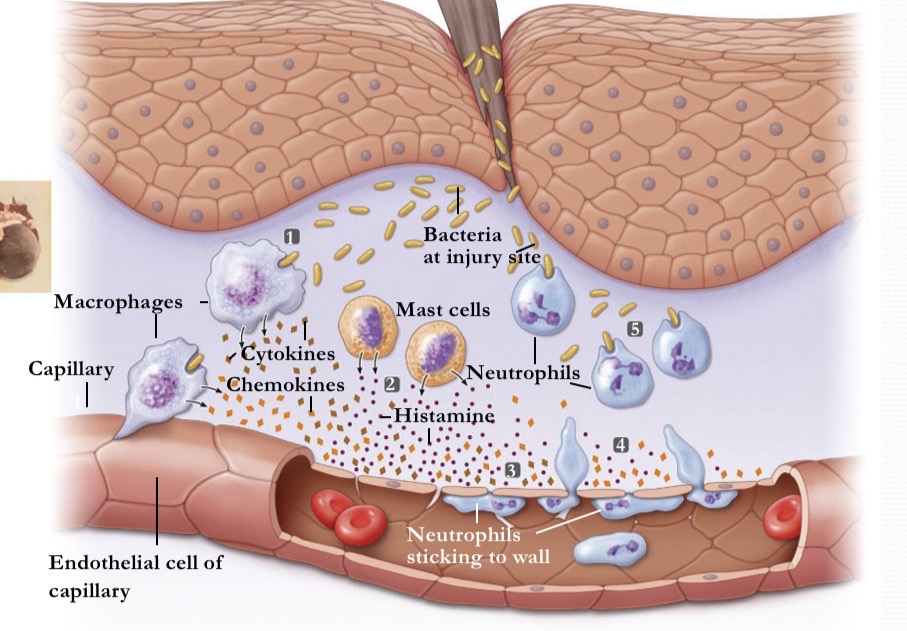 <p>What occurs during inflammation at stage 5</p>