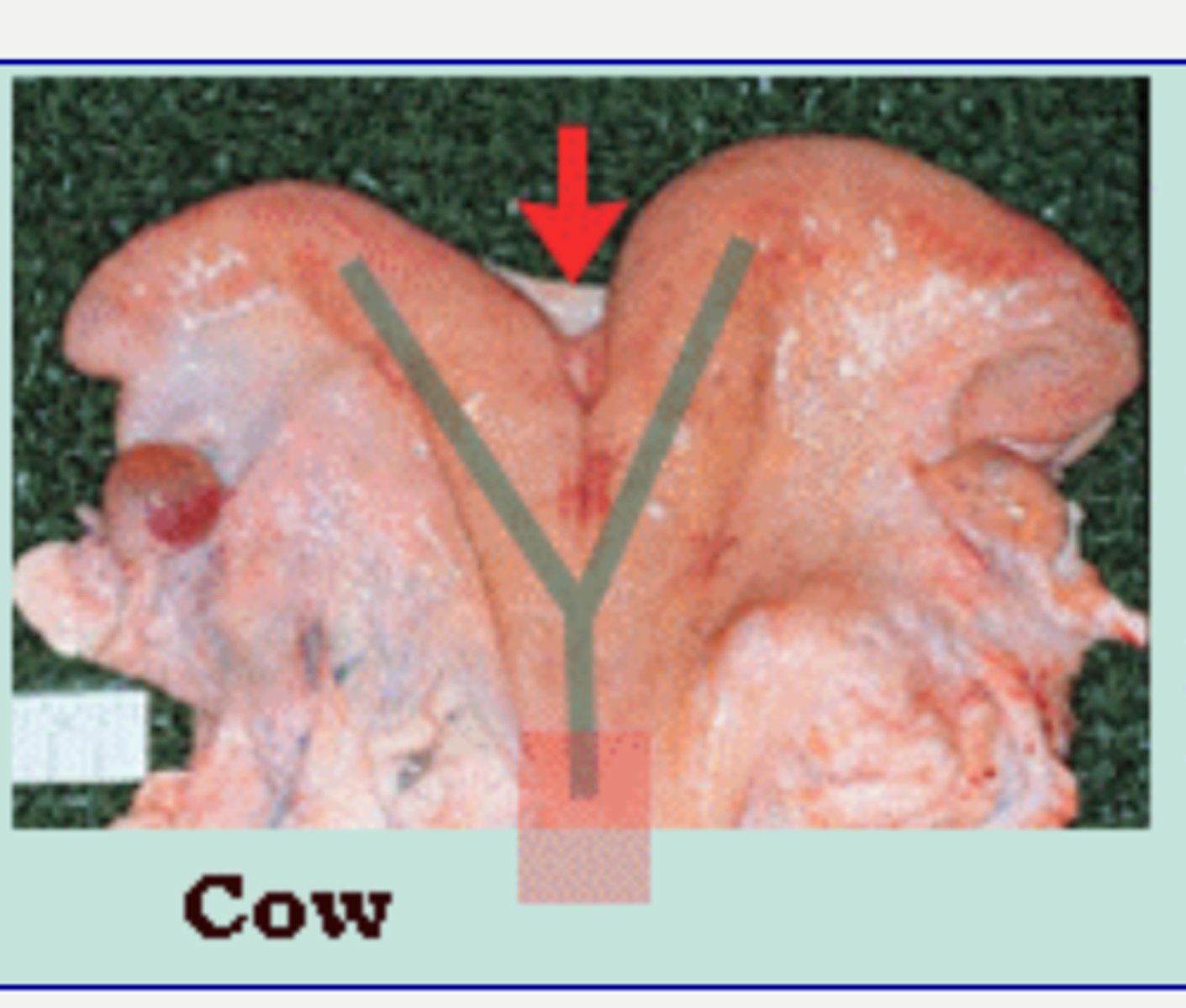 <p>intercornual ligament</p>