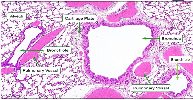 <p>Bronchus and Bronchiole</p>